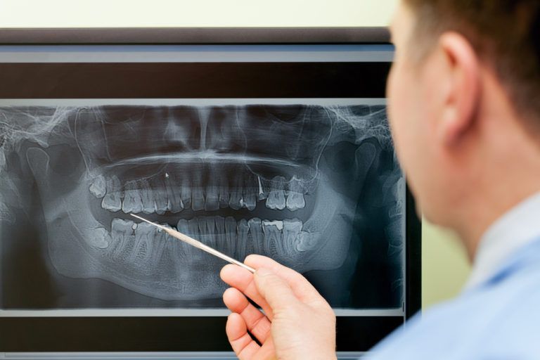 Dentist looking teeth on digital X-Ray computer monitor