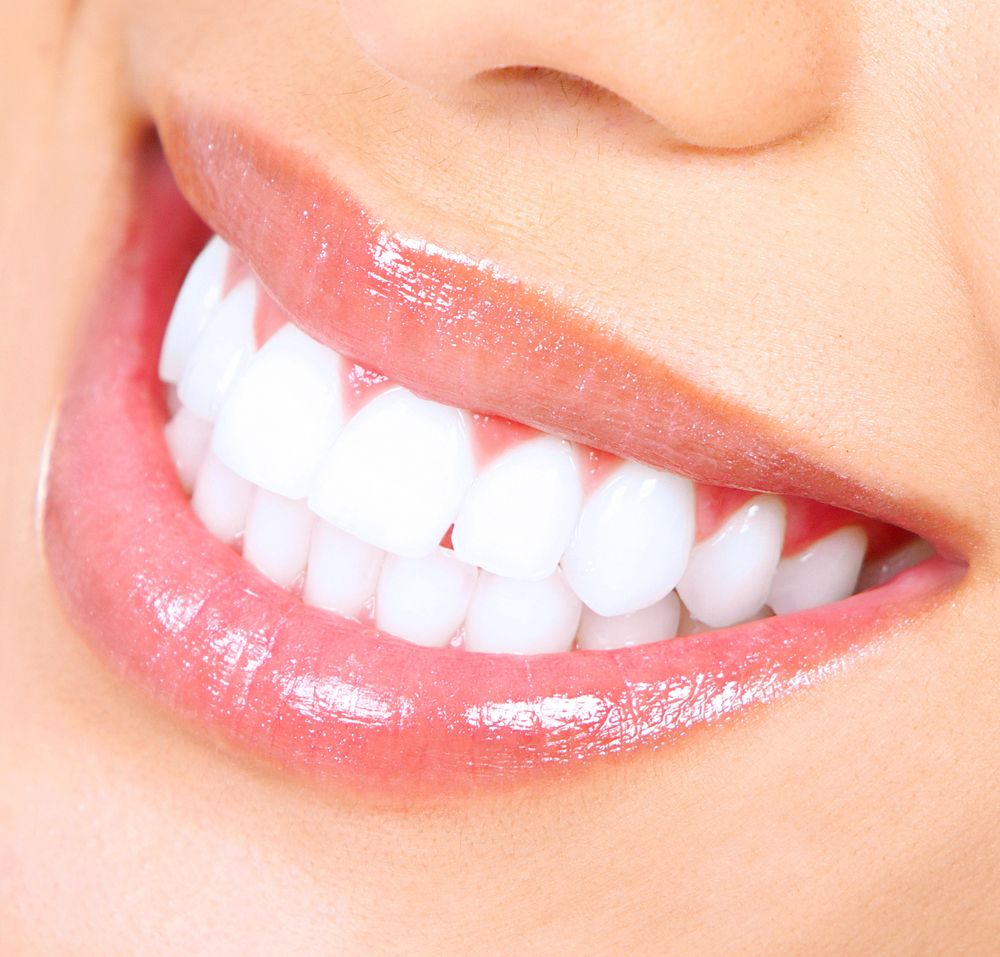 Teeth Whitening For Patients In City